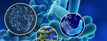 Legionnaires' disease is a serious type of pneumonia caused by legionella bacteria. What Is Legionnaire S Disease Water Treatment Wales