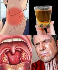 Recipe for sore throat relief