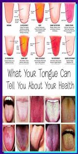 What Does Your Tongue Say About Your Health In 2020 Tongue Health Healthy Tongue Health