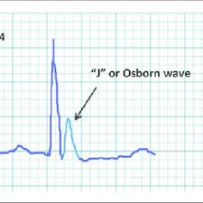 Image result for J Wave