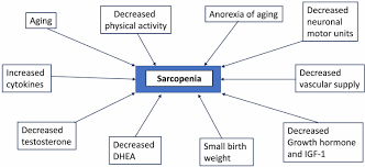 Sarcopenia is not a disease. Sarcopenia Definition Causes Symptoms Diagnosis Treatment