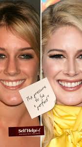 “Do you remember Heidi Montag…?”, Excuse me, WHAT kind of question is  that?! 🤯, Who could ever forget. , This week, Maggie & Tully dive into  Heidi’s infamous full-body-and-face “revamp” (?!) and ask ...
