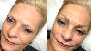 Case Study: Microblading for Mature Skin