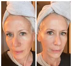 Can I see before and after pictures using the tinted Sun Shield as  foundation?