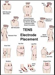 Ask Us How You Can Receive A Tens Unit To Take For Home Use Tens Unit Therapy Fibromyalgia Tens Electrode Placement