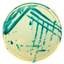 Image result for Vancomycin Resistant Enterococcus