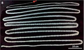 Image result for Beef Tapeworm