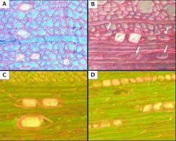 Maybe you would like to learn more about one of these? Prismatic Crystals Observed In Thin Cross Sections Under The Light Download Scientific Diagram