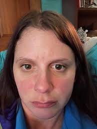 Does anyone get butt cheek pain and of the xiphoid