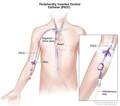 Peripherally Inserted Central Catheter Picc A Thin Flexible Tube That Is Inserted Into A Vein In The Up Oncology Nursing Pediatric Nursing Surgical Nursing