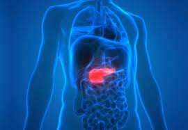 Normally, the liver releases a liquid called bile that contains bilirubin. Pancreatic Cancer It S On The Rise But There S Reason To Be Hopeful Cleveland Clinic