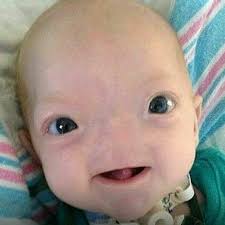 Um bebê que esbanja felicidade....