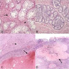 Some leydig cells are present at birth (these perhaps secrete the surge of testosterone present in the blood of male infants in their 2nd month see chapter 5), but by six months of age, these cells are. Ovo Testis Histology A Seminiferous Tubules Arrow Devoid Of Germ Download Scientific Diagram