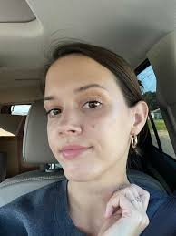 Hormone kit helps with facial issues