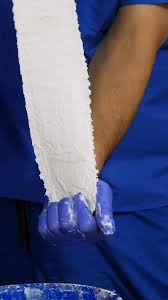 Image result for Long Arm Splint