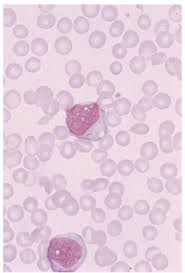 This technology simulates human thought and action for machines, especially computer systems. Nbme 29 Flashcards Quizlet