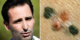 Göteborg kan bli först med cancerapp