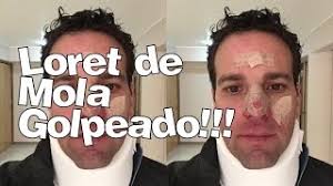 He is a popular news anchor in mexico, hosting a show called despierta on televisa's las estrellas. Accidente Carlos Loret De Mola Golpeado No Quiere A Su Papa Rafael Loret De Mola Youtube