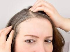 Today, boldsky shares with you grey hair reasons and causes of grey hair at an early age. Premature Greying Of Hair Know The Causes And Tips For Prevention From Dermatologist