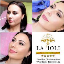 Bei Dieser Kundin Haben Wir Das Wangenvolumen Wieder Aufgebaut Mit Hyaluronsaure Lajoli Praxis Fur Asthetik In Hamburg Botox Lippen Faltenbehandlung