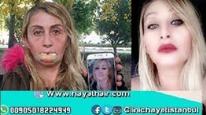 عمليات التجميل الفاشلة مركز الحياة الطبي