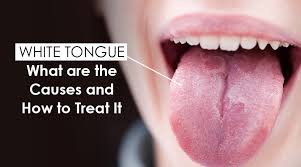 If getting rid of the source of the irritation doesn't help, the patch may need to be surgically removed. N2bofjihfhe0cm