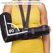 Image result for Long Arm Splint