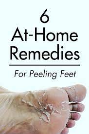 Peeling in feet and hands are a common problem for many people. 6 At Home Remedies For Peeling Feet Dry Feet Remedies Cracked Feet Remedies Dry Cracked Feet