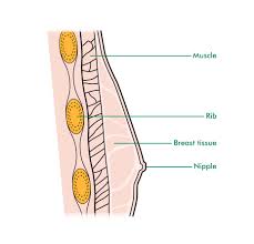 Many males with breast cancer have inherited a brca mutation, but there are other causes, including alcohol use disorder and exposure to certain hormones and ionizing radiation. Men Can Get Breast Cancer Too Macmillan Online Community