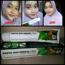 Pasta Gigi Herbal Hpai Pasta Gigi Propolis Dan Pasta Gigi Cengkeh Hpai Shopee Indonesia