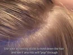 This Video Answers Our Most Popular Question How Can I Tell If It S Head Lice Head Lice Pictures Lice Pictures Eggs Lice Pictures