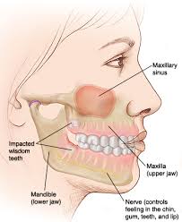 Wisdom teeth do not necessarily have to be removed. Understanding Wisdom Teeth Saint Luke S Health System