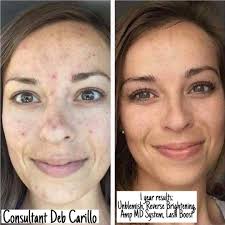 Tracy Dye Rodan + Fields Consultant
