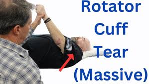 Image result for Rotator Cuff Injury
