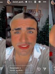 Ator diz ter contraído sarna com figurinos da Record TV e ameaça processar  emissora; assista