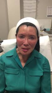 Dr. Mandy Wong getting prepped for a...