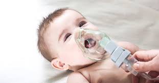Als pseudokrupp oder pseudocroup wird eine unspezifische entzündung der oberen atemwege im bereich des kehlkopfes (larynx) unterhalb der stimmritze (glottis) bezeichnet, die durch einen charakteristischen bellenden husten („schafhusten. Pseudokrupp Bei Kindern Kindaktuell At