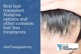 4.7 from 3 verified reviews. Best Hair Transplant Malaysia Type Available And Other Common Medically Proven Hair Loss Treatments