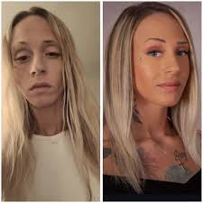 💜 What does recovery mean to me? 💜 'I came into the well for a 3rd time 