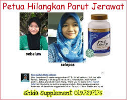 Banyak cara yang dilakukan orang untuk menghilangkan jerawat. Kulit Cantik Tanpa Parut Jerawat Cantik Semulajadi Tanpa Make Up Shidarahmat