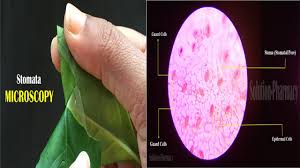 The black sorus is riper than the white one. How To Prepare Stomata Slide For Microscopic Study Of Stomata English By Solution Pharmacy Youtube
