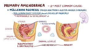 Why is it a problem? Amenorrhea Osmosis