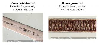 The diagnosis of mange is made by observing the mites under a microscope. Hair Under A Microscope Rs Science