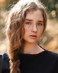 So charming freckles