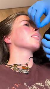 Lip Piercing Process: Step-by-Step Guide