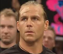 Man why I feel like Shawn Michaels always had a bandaid