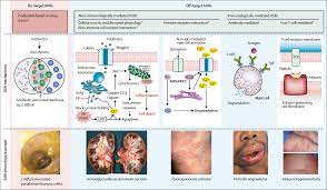Antibiotic Allergy The Lancet