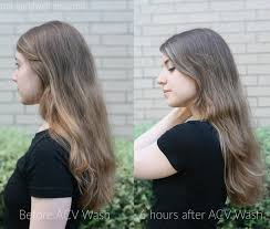Using apple cider vinegar on your hair can help boost shine and promote hair growth. How To Use Apple Cider Vinegar For Beautiful Hair Unbound Wellness