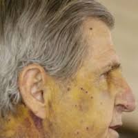 Family tree of Harry Whittington