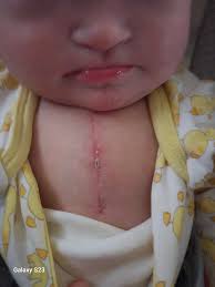 Remembering a loved one